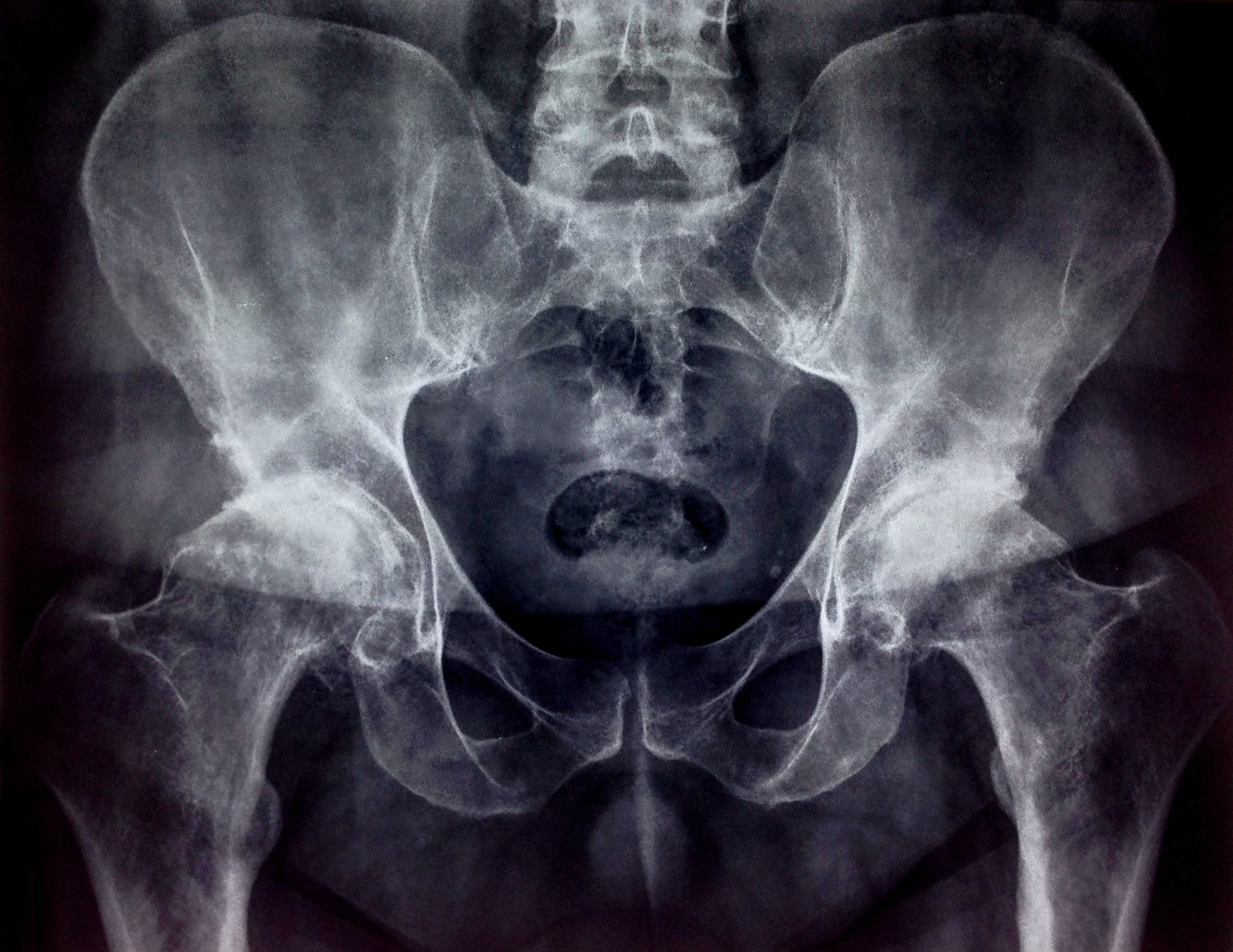X-Ray_Web